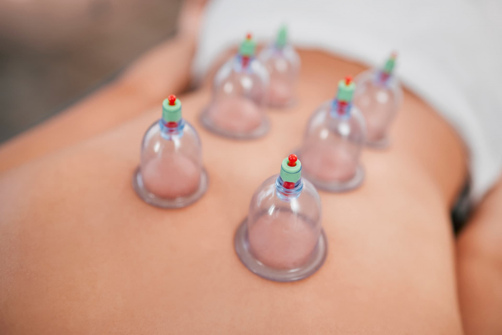 spa-healthy-body-and-cupping-therapy-for-stress-2022-12-22-20-04-18-utc (1).jpg